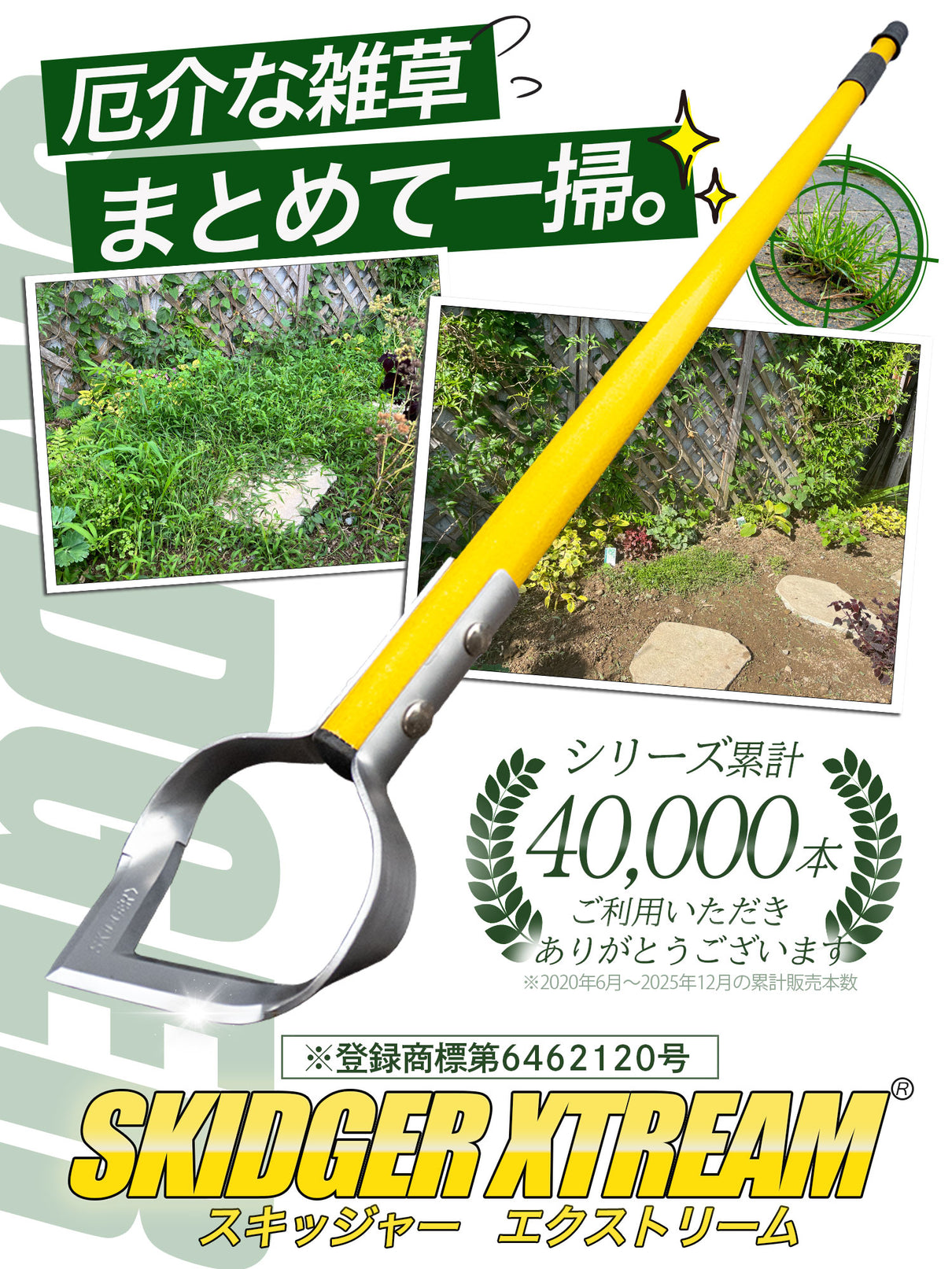 スキッジャー®︎