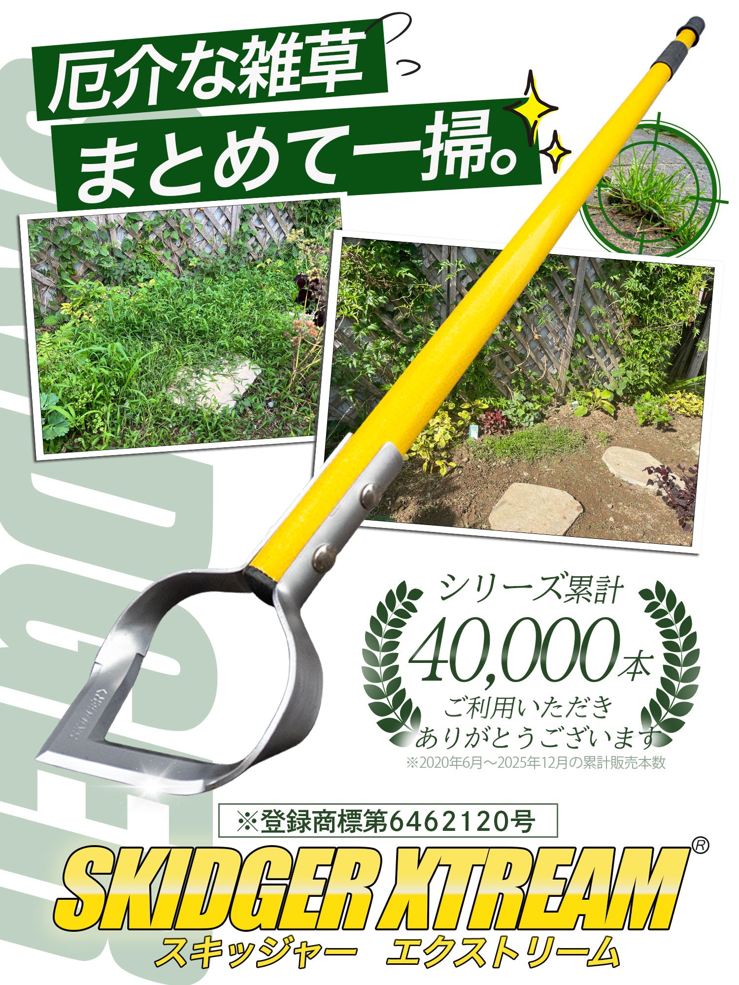 スキッジャー®︎